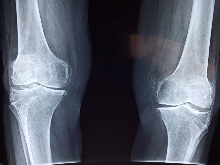 An Overview: Orthopedics -Dr. Kevin Crawford