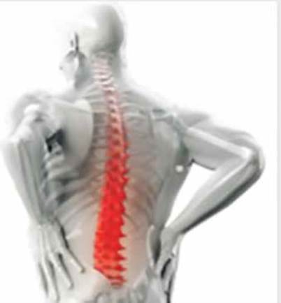 BankOnIP Patent Owner Invents The BackFree